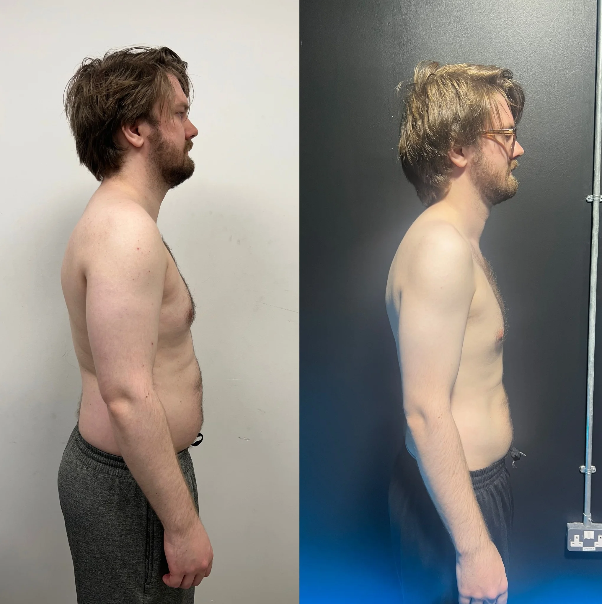 Albin transformation
